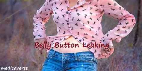 belly button is leaking|Belly Button Discharge: Causes, Treatment, Outlook,。